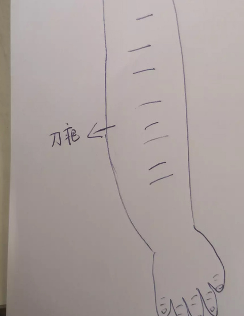 1535074437314634.png